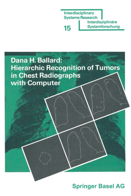 Hierarchic Recognition of Tumors in Chest Radiographs with Computer Hierarchic Recognition of Tumors in Chest Radiographs with Computer