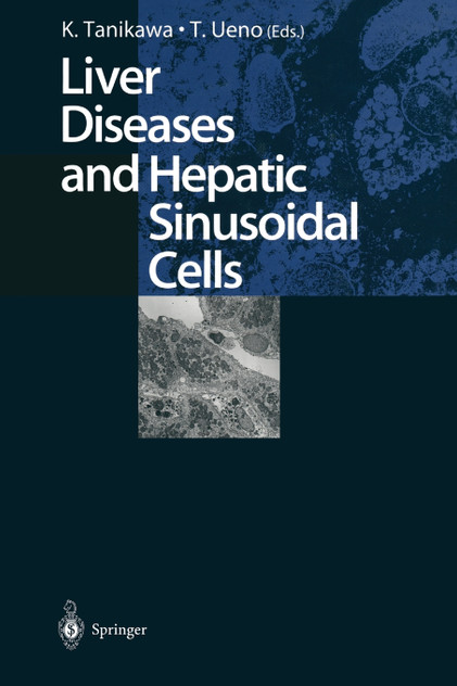 Liver Diseases and Hepatic Sinusoidal Cells Liver Diseases and Hepatic Sinusoidal Cells