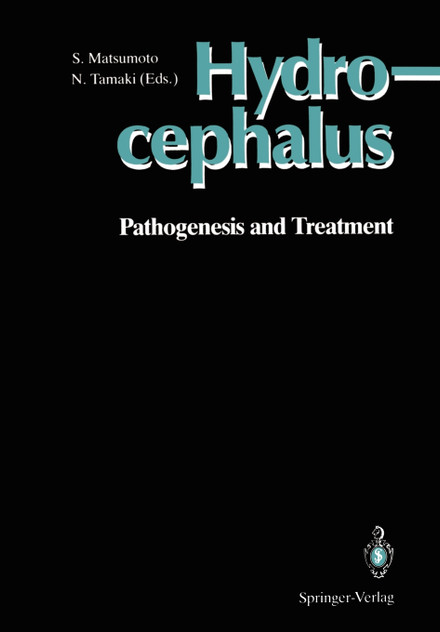 Hydrocephalus Hydrocephalus
