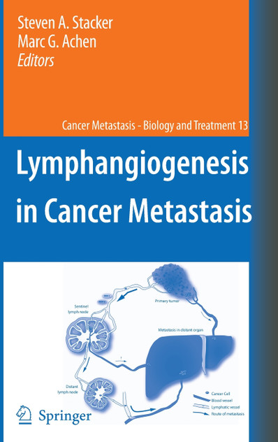 Lymphangiogenesis in Cancer Metastasis Lymphangiogenesis in Cancer Metastasis