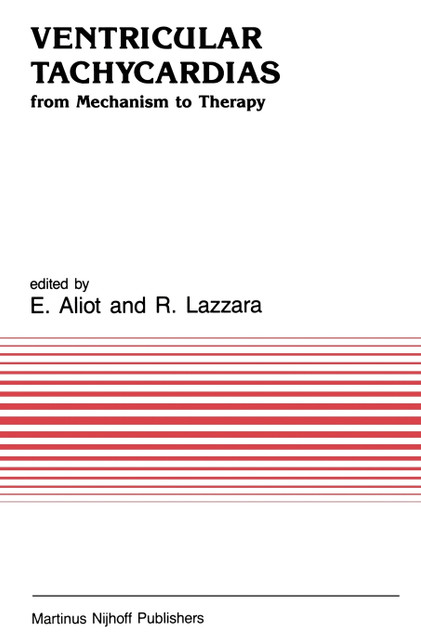 Ventricular Tachycardias Ventricular Tachycardias
