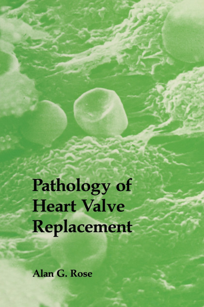 Pathology of Heart Valve Replacement Pathology of Heart Valve Replacement