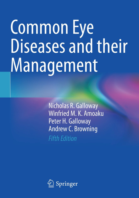 Common Eye Diseases and their Management Common Eye Diseases and their Management