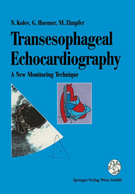 Transesophageal Echocardiography