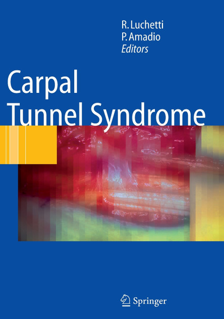 Carpal Tunnel Syndrome Carpal Tunnel Syndrome