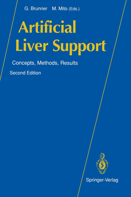 Artificial Liver Support Artificial Liver Support