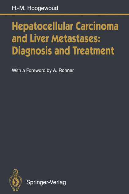 Hepatocellular Carcinoma and Liver Metastases Hepatocellular Carcinoma and Liver Metastases