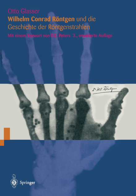 Wilhelm Conrad Röntgen und die Geschichte der Röntgenstrahlen Wilhelm Conrad Röntgen und die Geschichte der Röntgenstrahlen