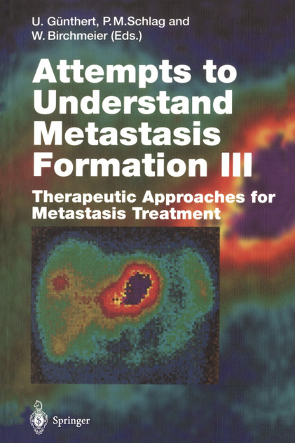 Attempts to Understand Metastasis Formation III Attempts to Understand Metastasis Formation III