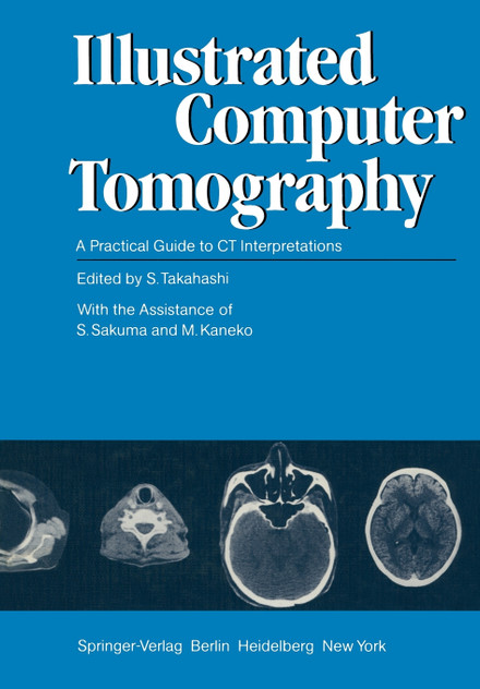 Illustrated Computer Tomography Illustrated Computer Tomography