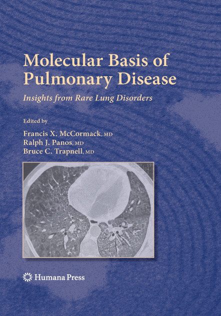 Molecular Basis of Pulmonary Disease Molecular Basis of Pulmonary Disease
