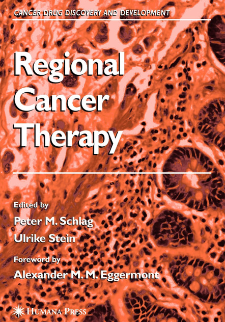 Regional Cancer Therapy Regional Cancer Therapy