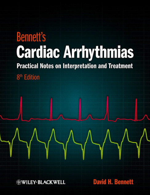 Bennett's Cardiac Arrhythmias Bennett's Cardiac Arrhythmias