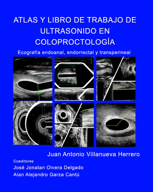 Atlas y Libro de Trabajo de Ultrasonido en Coloproctología Atlas y Libro de Trabajo de Ultrasonido en Coloproctología