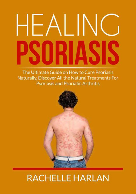 Healing Psoriasis Healing Psoriasis