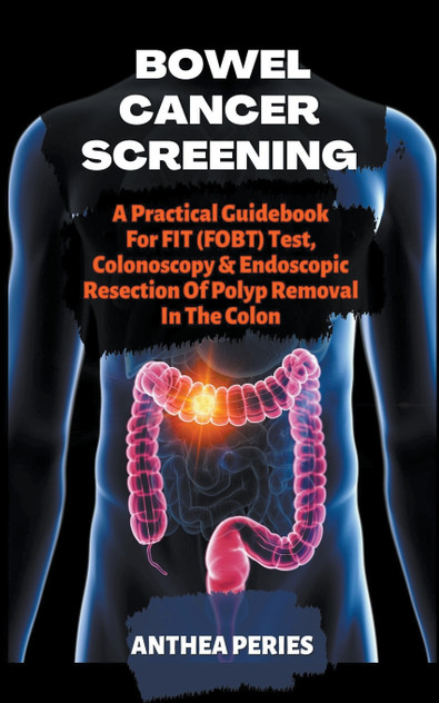 Bowel Cancer Screening Bowel Cancer Screening
