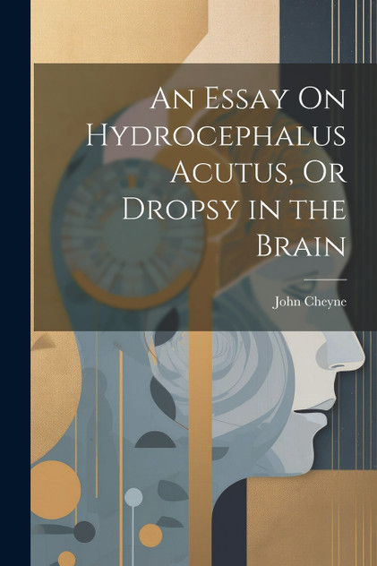 An Essay On Hydrocephalus Acutus, Or Dropsy in the Brain An Essay On Hydrocephalus Acutus, Or Dropsy in the Brain