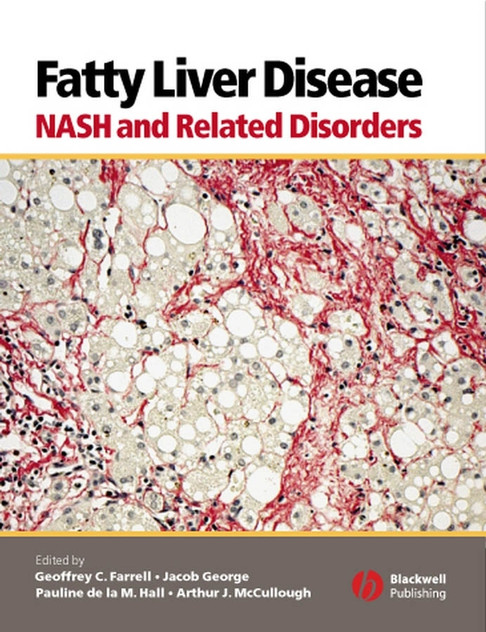 Fatty Liver Disease Fatty Liver Disease