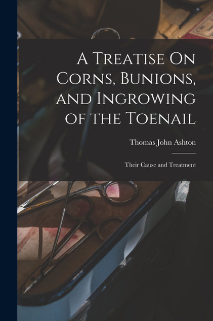 A Treatise On Corns, Bunions, and Ingrowing of the Toenail