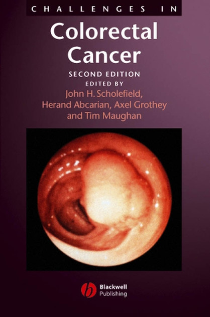 Challenges in Colorectal Cancer Challenges in Colorectal Cancer