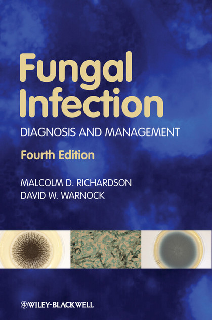 Fungal Infection Fungal Infection