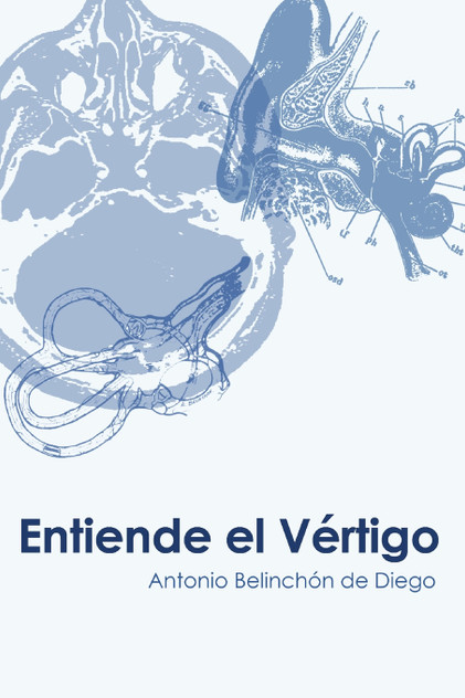 Entiende el vértigo Entiende el vértigo