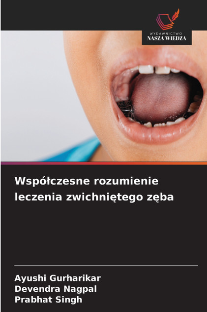 Współczesne rozumienie leczenia zwichniętego zęba