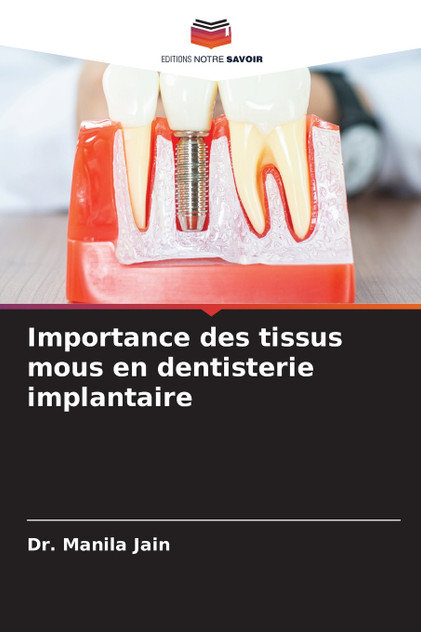 Importance des tissus mous en dentisterie implantaire