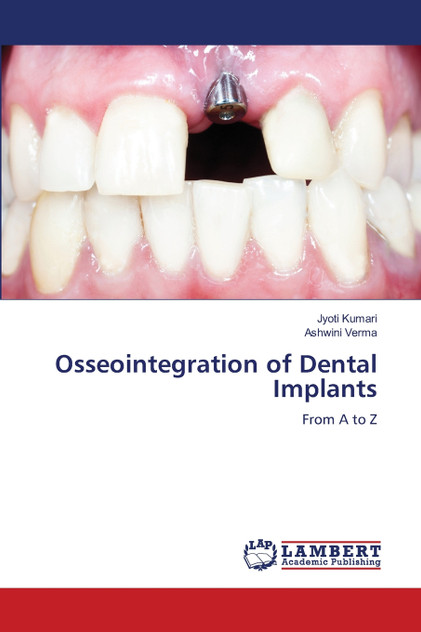 Osseointegration of Dental Implants Osseointegration of Dental Implants