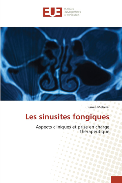 Les sinusites fongiques Les sinusites fongiques