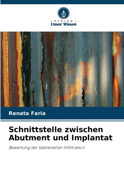 Schnittstelle zwischen Abutment und Implantat Schnittstelle zwischen Abutment und Implantat