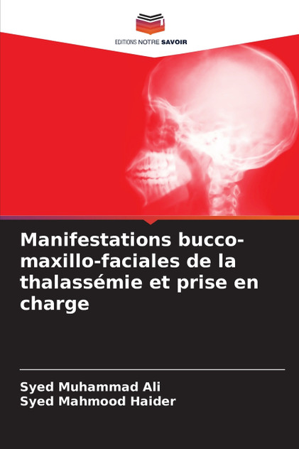 Manifestations bucco-maxillo-faciales de la thalassémie et prise en charge Manifestations bucco-maxillo-faciales de la thalassémie et prise en charge