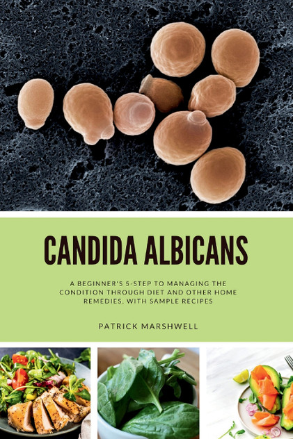 Candida Albicans : A Beginner's 5-Step to Managing the Condition Through Diet and Other Home Remedies, With Sample Recipes by Patrick Marshwell (Paperback)