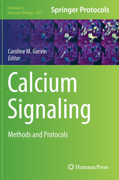 Calcium Signaling by Caroline M. Gorvin (Hardcover)