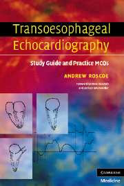 Transoesophageal Echocardiography