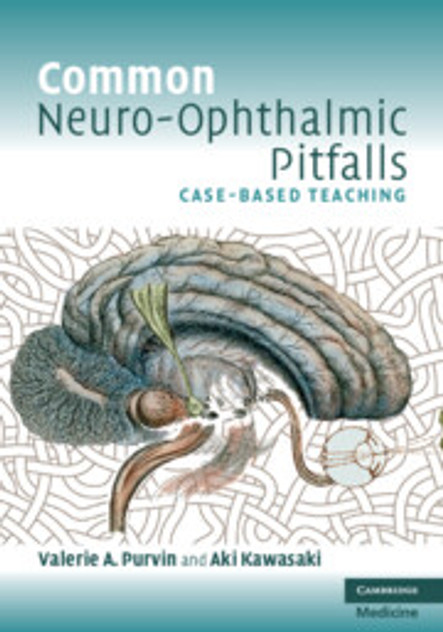 Common Neuro-Ophthalmic Pitfalls Common Neuro-Ophthalmic Pitfalls