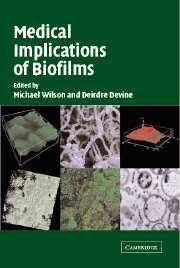 Medical Implications of Biofilms
