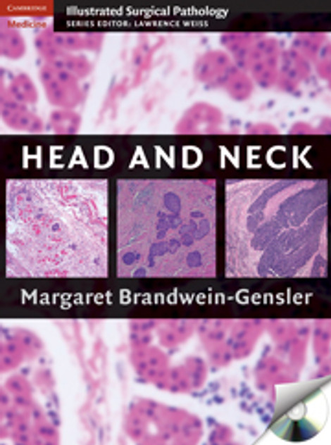 Head and Neck Head and Neck
