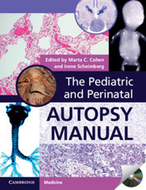 The Pediatric and Perinatal Autopsy Manual with DVD-ROM The Pediatric and Perinatal Autopsy Manual with DVD-ROM