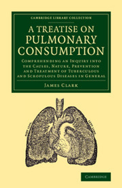 A Treatise on Pulmonary Consumption A Treatise on Pulmonary Consumption