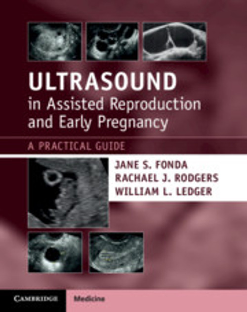 Ultrasound in Assisted Reproduction and Early Pregnancy Ultrasound in Assisted Reproduction and Early Pregnancy