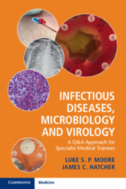 Infectious Diseases, Microbiology and Virology Infectious Diseases, Microbiology and Virology