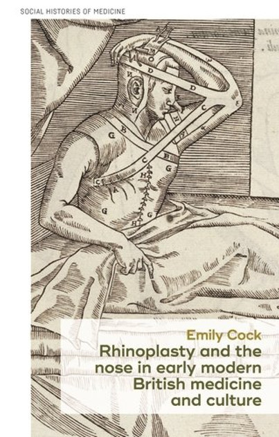 Rhinoplasty and the nose in early modern British medicine and culture Rhinoplasty and the nose in early modern British medicine and culture