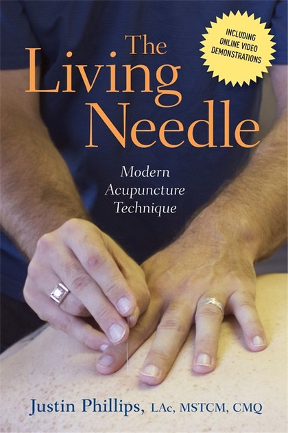 Living Needle: Modern Acupuncture Technique