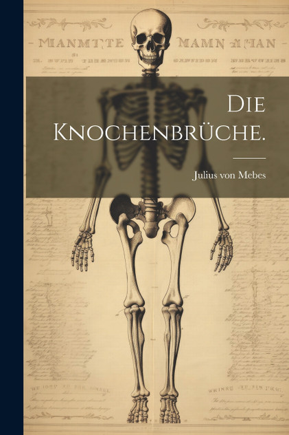 Die Knochenbrüche. Die Knochenbrüche.