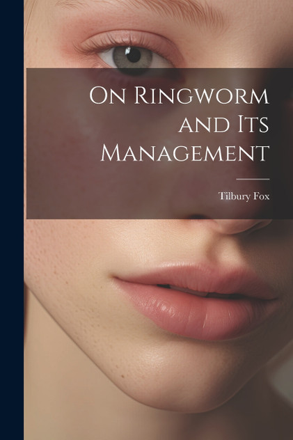 On Ringworm and Its Management On Ringworm and Its Management