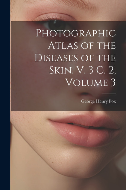 Photographic Atlas of the Diseases of the Skin. V. 3 C. 2, Volume 3 Photographic Atlas of the Diseases of the Skin. V. 3 C. 2, Volume 3