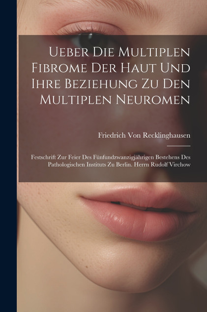 Ueber Die Multiplen Fibrome Der Haut Und Ihre Beziehung Zu Den Multiplen Neuromen Ueber Die Multiplen Fibrome Der Haut Und Ihre Beziehung Zu Den Multiplen Neuromen