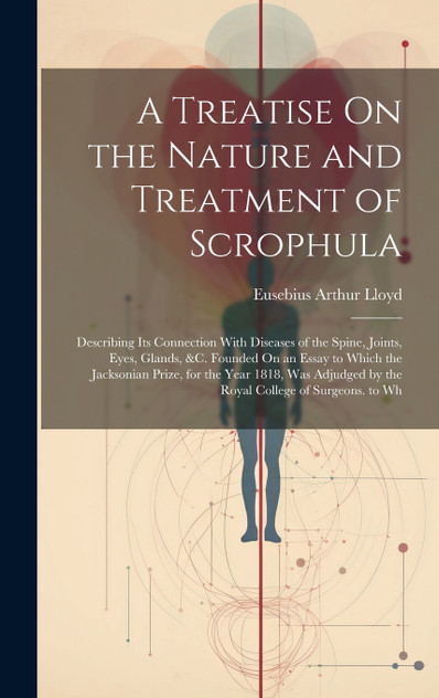 A Treatise On the Nature and Treatment of Scrophula