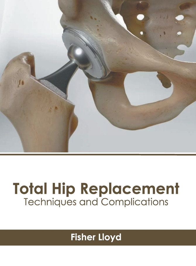Total Hip Replacement